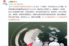 危险！女子用按摩仪减肥把肾压扁进ICU图片
