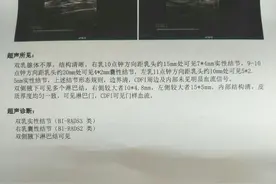 什么样的乳腺结节，容易发展成乳腺癌呢？这篇文章一定要收藏好了图片