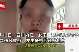 “我要弄死你”儿媳穿短裤被公公抓伤？老公：让你别穿就别穿！图片