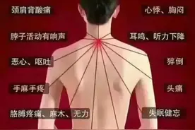 早晨醒来双手发胀，握不拢，几分钟后就正常了，是怎么回事？图片