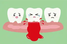 经常牙龈出血？别不当回事，这5个原因看看有没有中招的图片