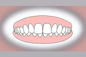 牙齿深覆合是什么？有什么危害吗？图片