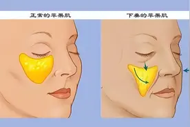 教你一招，判断面部松弛情况图片