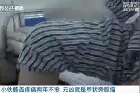 南京小伙膝盖疼痛两年不愈 元凶竟是甲状旁腺瘤图片