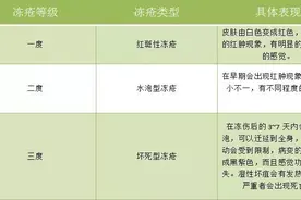 长期冻疮患者亲测六款冻疮膏，到底哪一款才是性价比最高？图片