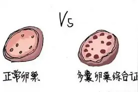 多囊，究竟是什么？图片
