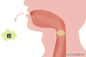 寒生痰、气生痰、瘀也生痰，一盒中成药，从头到脚化痰湿图片