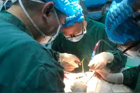 65岁男子头晕头痛，医生从他颈动脉里取出一条2cm长的内膜和斑块图片