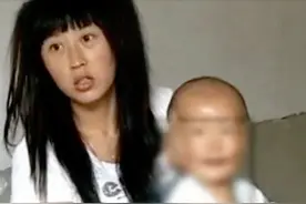 2010年湖南1岁男孩，天生带着一个面具，旁人都相劝快扔掉图片