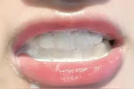 牙黄、牙渍真的刷掉了！过来人教你三招，不出一月牙齿亮白如新图片