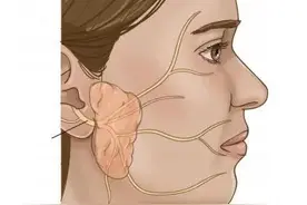 我的腮腺混合瘤的治疗经历图片