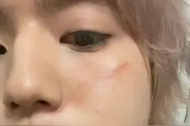 25岁男星发文道歉，承认对好友使用暴力，用碎片把对方脸部划伤图片