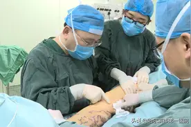 如何判断“静脉曲张”怎样预防与治疗——哈尔滨市第一医院血管外科专家周伟忠为您答疑解惑图片