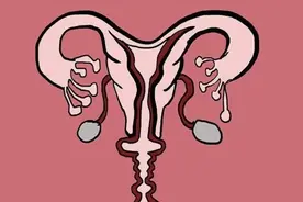 “石女”和正常人有什么区别呢？她们能正常结婚生育吗？图片