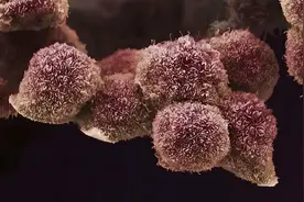开启探索胰腺癌治疗的又一扇门：标准化疗联合维生素A是安全的图片
