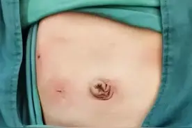 警惕！这种吐奶很危险！阜阳医生重要提醒…图片