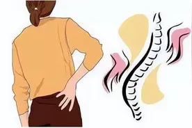 腰椎间盘突出的典型6大症状，6种预防办法，一套简单腰背肌锻炼操图片