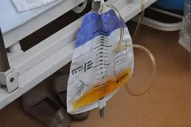 手术“插尿管”是什么体验？对以后生活有影响吗？听听患者怎么说图片