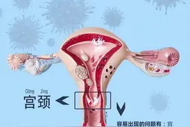 宫颈炎不能拖，有这些症状，你要当心了图片