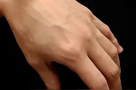 手背上凸起的肿块被我捏瘪了，医生我还有救吗？图片