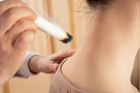 艾灸上火是正常现象吗？真相来了图片