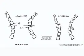 亲身经历过颈椎不稳，来谈谈我对颈椎不稳的认识总结图片