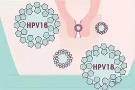 感染HPV提高免疫力 容易被忽略的6点！图片