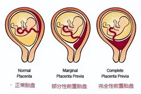 怀孕挤地铁，我差点失去了宝宝...图片
