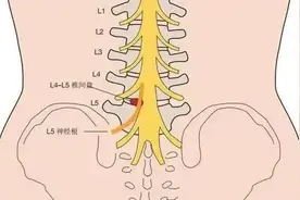 骶骨疼痛的原因有哪些？图片
