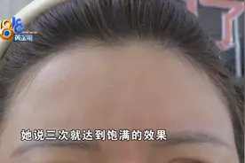 打完童颜针脸上红肿烫，“聚”字该往哪里摆图片