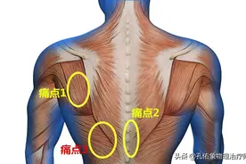 肩胛区域及后背疼是咋回事？提醒：可能是癌症转移，尽早做筛查图片