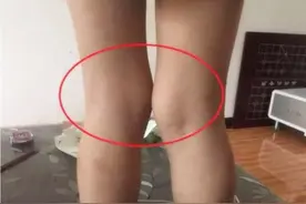 亚洲孩子的腿型VS欧美孩子的腿型，对比很明显，为啥后者腿更直？图片