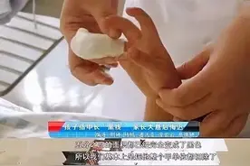 指甲上这种黑线小心会癌变！孩子指甲有这5种表现，要警惕图片