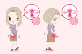 提醒女性：体内若有子宫肌瘤，身体往往会有5个异常，需及时就医图片