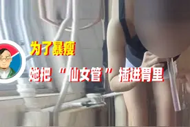 为了暴瘦，她把“仙女管”插进胃里图片