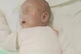 揪心！9个月女婴不慎打翻开水，全身烫伤图片