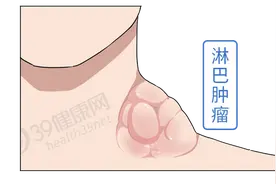 体内有癌，皮肤报信？提醒：4种皮肤“瘙痒”，或是癌症发出信号图片