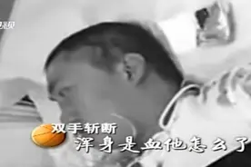 2011年，高三学生与富二代起冲突双手被断，打人家属：有的是钱图片