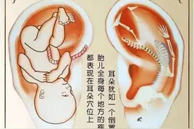 耳穴压丸之感冒治疗篇丨杏林之声图片