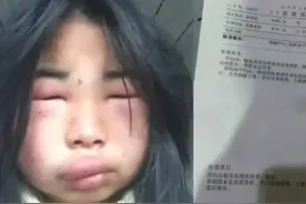 闹大了！女孩被8人轮流掌掴后续：警方介入，教育局处理结果来了图片