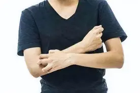 剧烈瘙痒、皮疹，反复发作？警惕！可能是特应性皮炎图片
