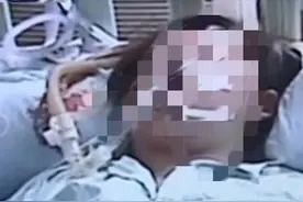 吃了一根路边的烤肠，孩子被送进抢救室，可能面临瘫痪图片
