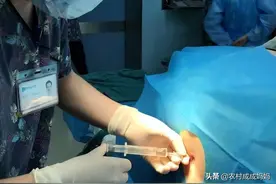 为什么女明星宁愿肚子上留有疤痕，也会选择剖腹产，顺产不好吗图片