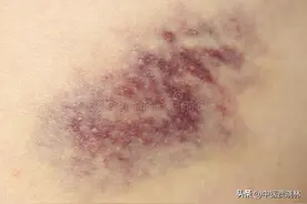 心脏不好，人就易倒，送你3个治疗心脑血管的中成药，建议收藏图片
