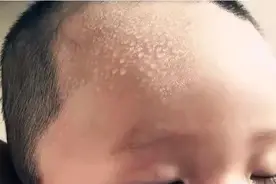 孩子晚上睡觉出汗多，可能是这3种疾病在作怪，家长要注意了图片