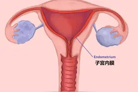 来大姨妈时里面有“肉块”，是不是生病了？图片