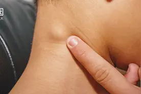 小孩子患癌的诱因有哪些？答：通过吃摄入的竟然最多图片