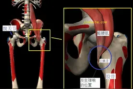 大腿内侧隐隐作痛？可能是“弹响髋”惹的祸图片