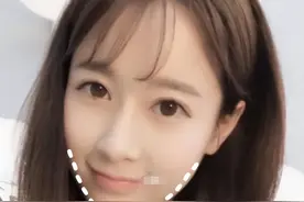 “瘦脸针”有多受欢迎？柳岩、王菲、大S等女星都曾坦言自己打过图片