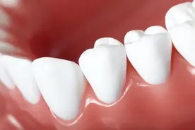 你了解牙龈萎缩吗？是什么导致了牙龈萎缩？这几点要多关注图片